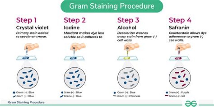 Grey stain - How To Discuss