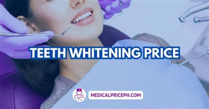 Teeth whitening price - How To Discuss