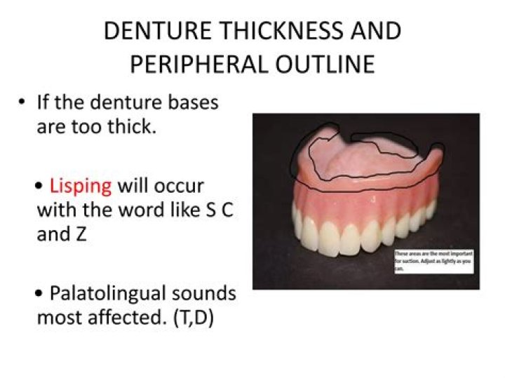 Upper Denture Too Thick - How To Discuss