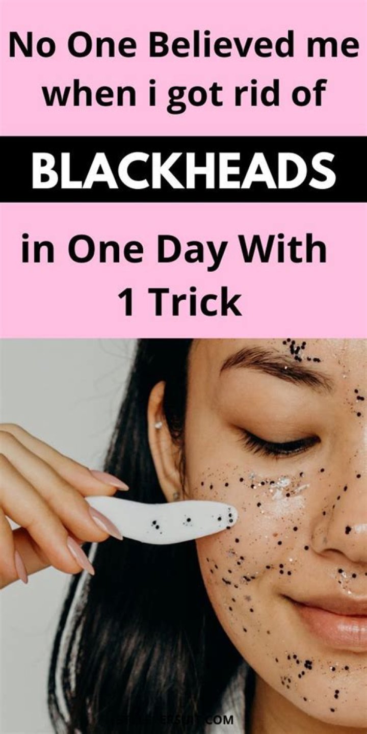 What gets rid of blackheads