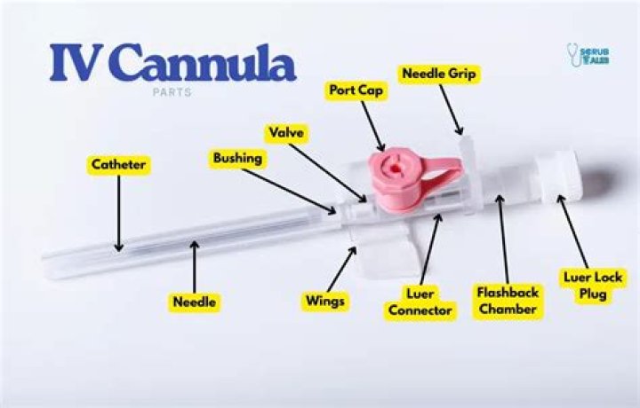 What is a cannula - How To Discuss